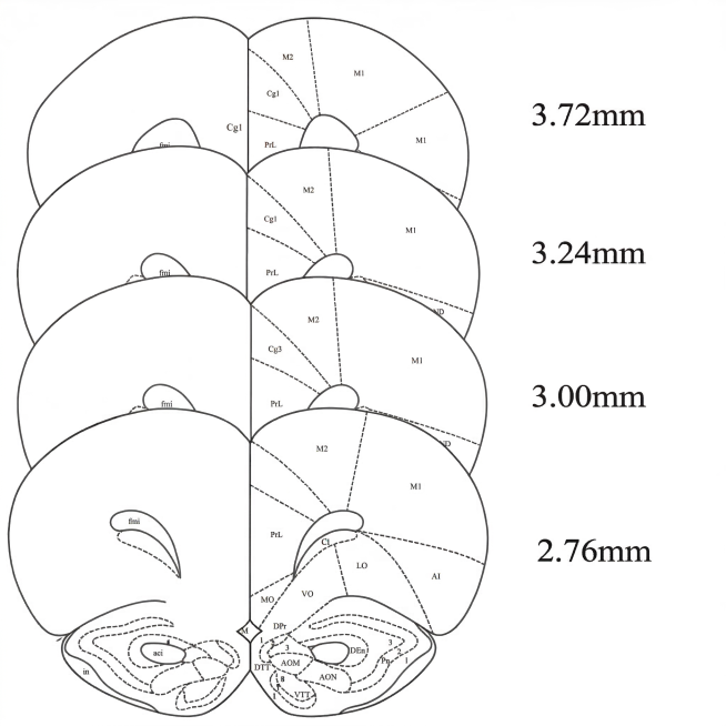 移除图左半部分中的Cg1文字标注，保留其余所有脑区分区线条、文字标注和结构不变，保持整体的线稿风格和白色背景预览效果