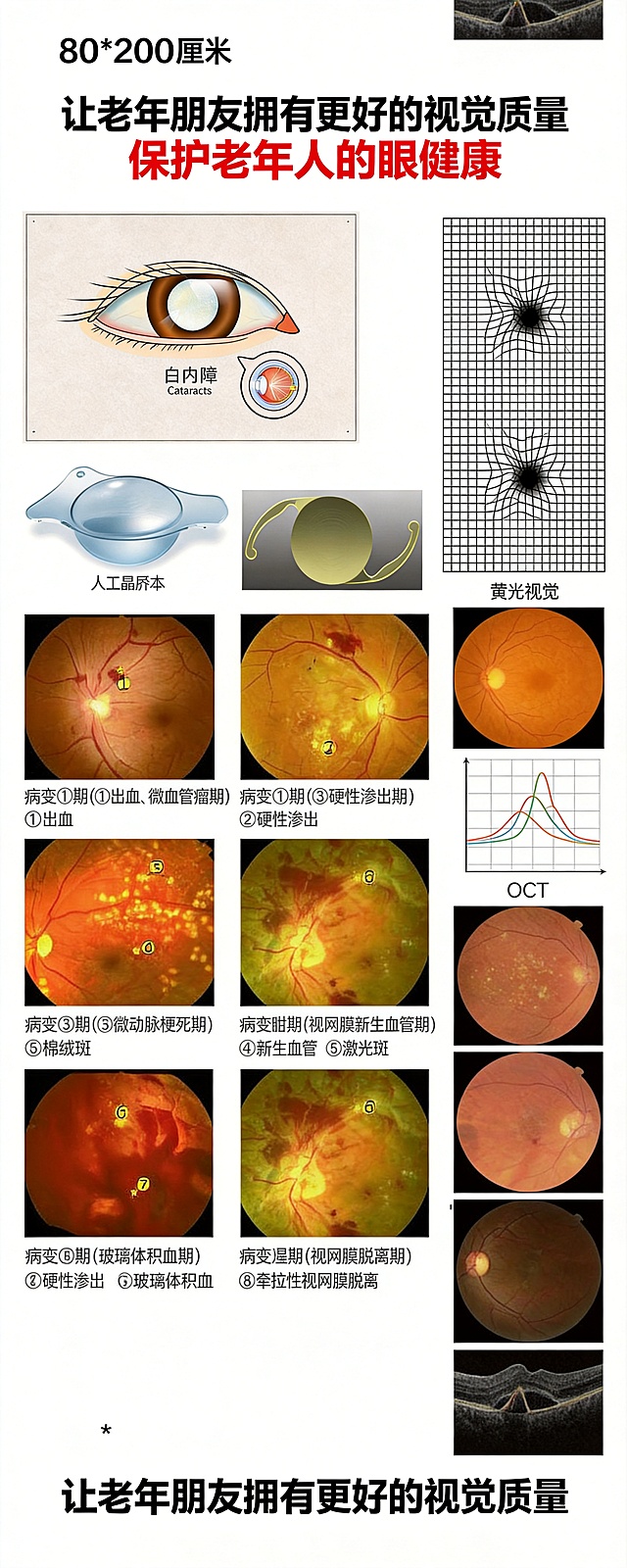 设计一张80*200厘米的竖版护眼宣传海报，主题为保护老年人眼健康，保留原图所有图文内容，包含白内障、糖尿病视网膜病变、黄斑病变科普内容，排版整齐清晰，医疗科普宣传风格，白底图文