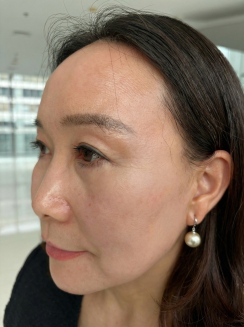 去除图中红色圈出位置的皮肤红疹和伤口，让皮肤看起来自然平整，与周围皮肤衔接自然预览效果