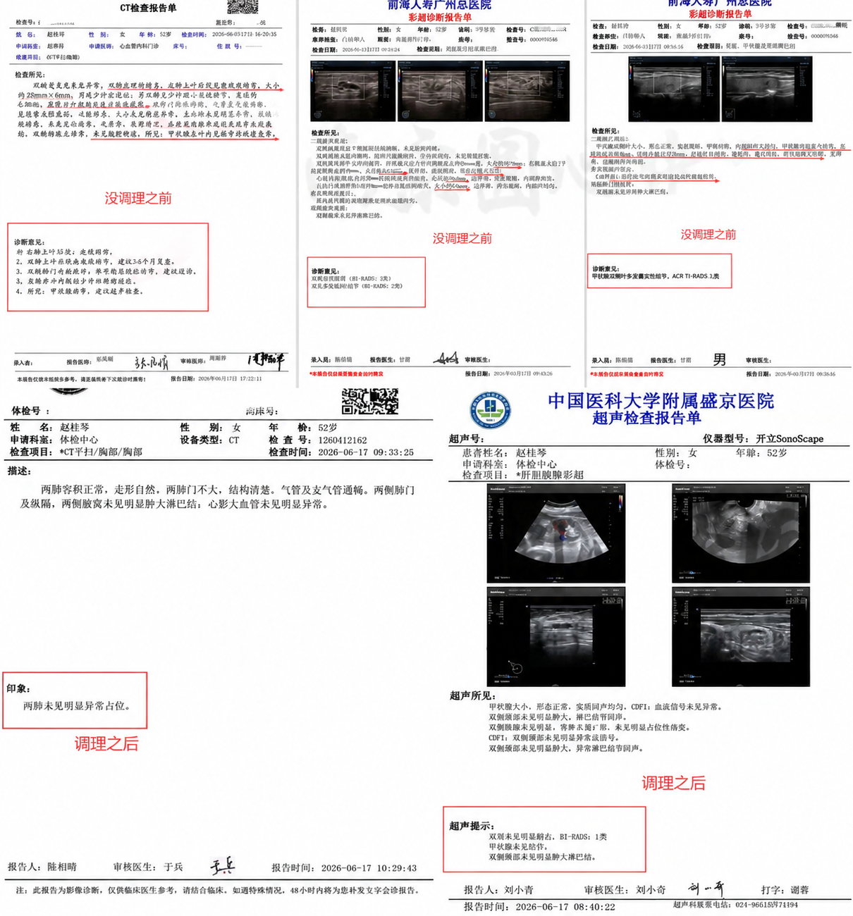 基于这张图进行水印移除：图中中部偏下位置有一个半透明文字/Lo… - 图片创意预览