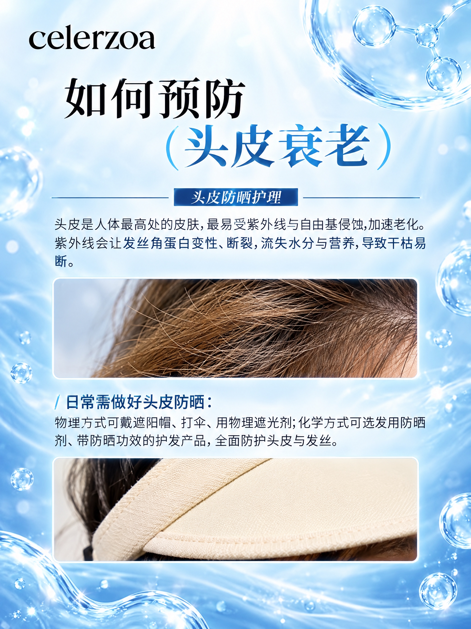 将这张头皮护理科普图改成与上一张海报相同的高级蓝调医美风格：背… - 图片创意预览