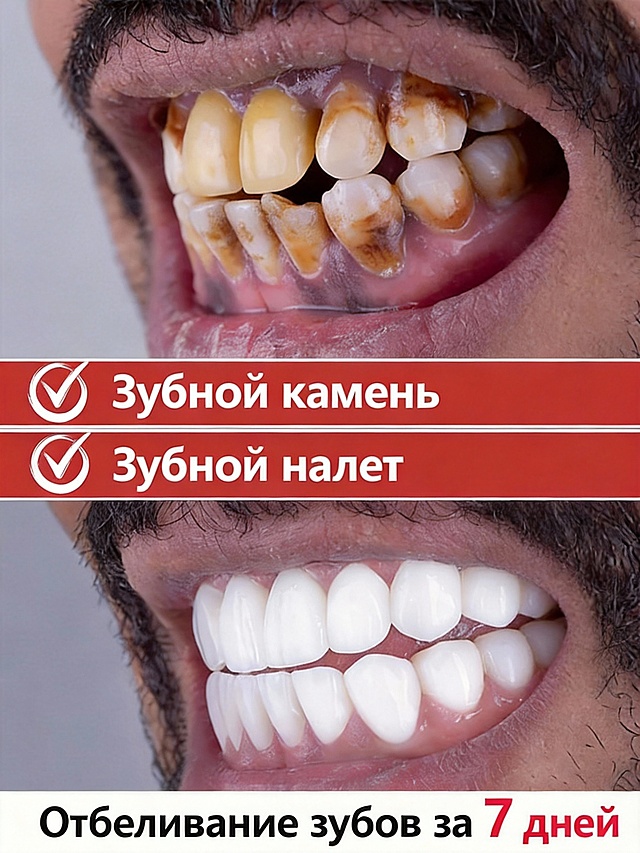 去掉左上角的标和牙膏，其他一切保持不变