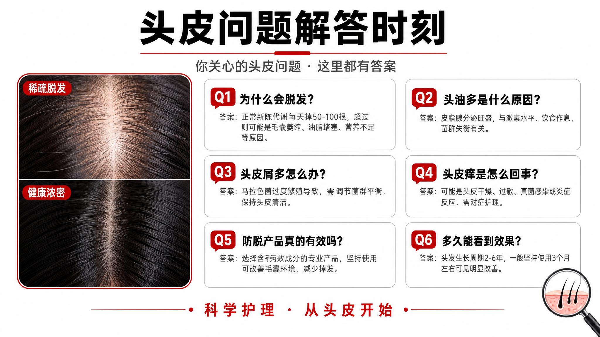 修改这张头皮问题解答时刻PPT页面，加入脱发相关的图片，文字适… - 图片创意预览