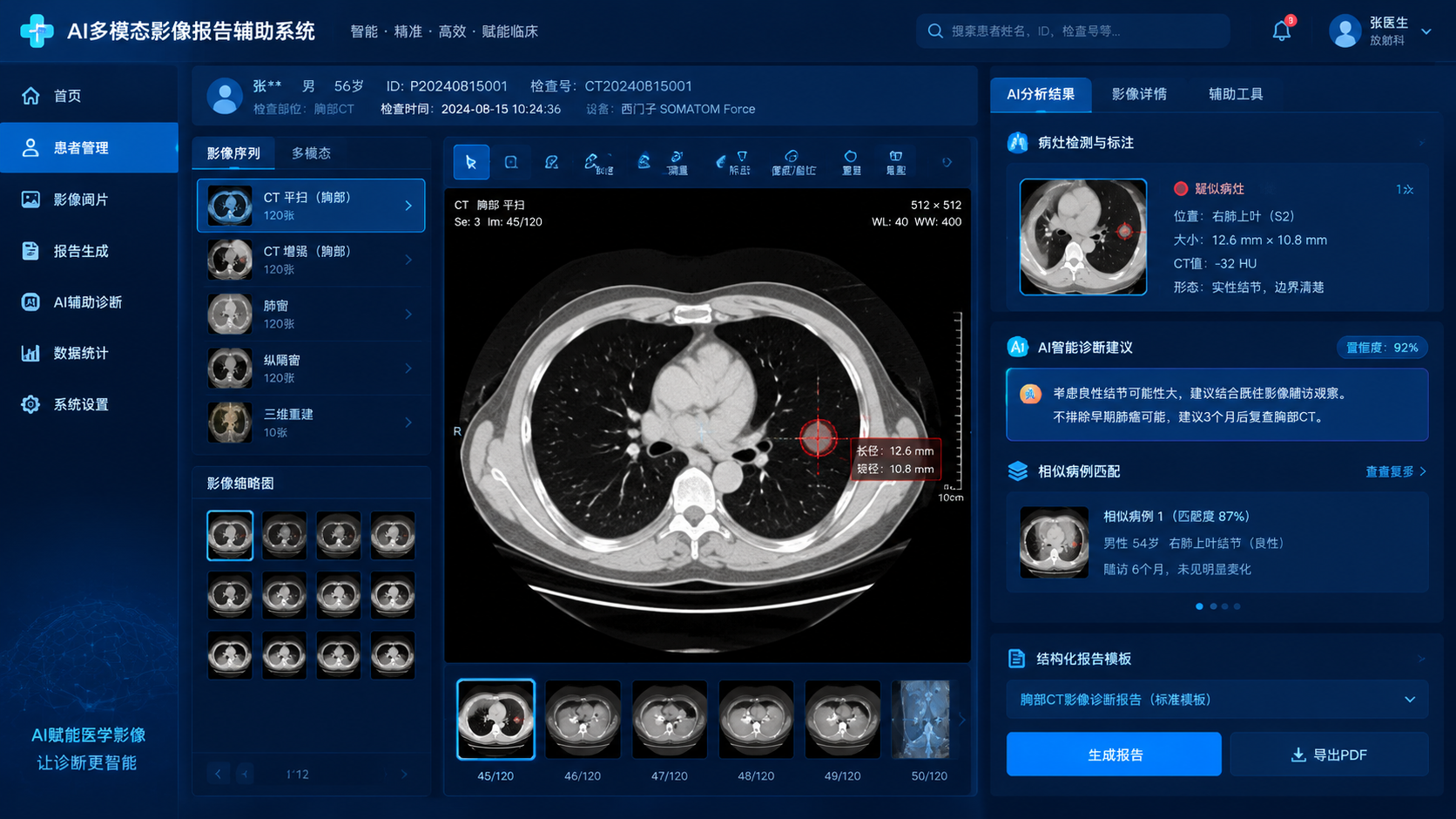 PC版AI多模态影像报告辅助系统的UI界面设计图，16:9宽屏… - 图片创意预览