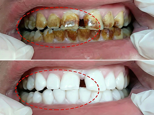 去掉右边的产品