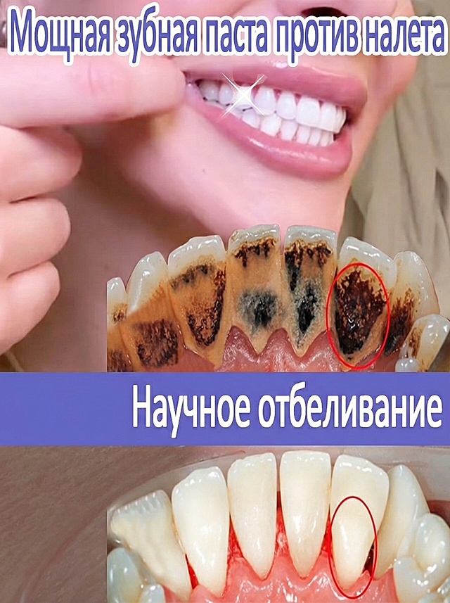 去掉左下角的产品