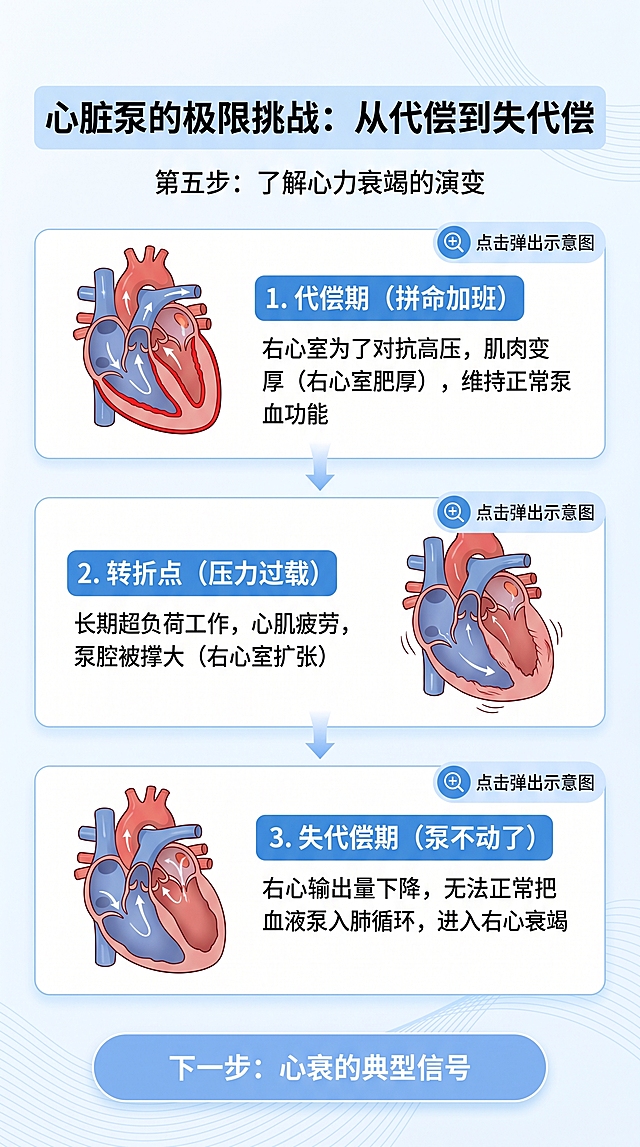 H5科普第五步页，标题“心脏泵的极限挑战：从代偿到失代偿”，分三个阶段：1.代偿期（拼命加班）：右心室为了对抗高压，肌肉变厚（右心室肥厚），维持正常泵血功能；2.转折点（压力过载）：长期超负荷工作，心肌疲劳，泵腔被撑大（右心室扩张）；3.失代偿期（泵不动了）：右心输出量下降，无法正常把血液泵入肺循环，进入右心衰竭，每个阶段预留点击弹出示意图的区域，底部有圆角矩形交互按钮，按钮内文字“下一步：心衰的典型信号”，简约医疗科普风格