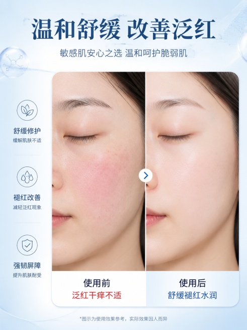 「图片1」模特效果展示，敏感肌使用前后状态对比预览效果