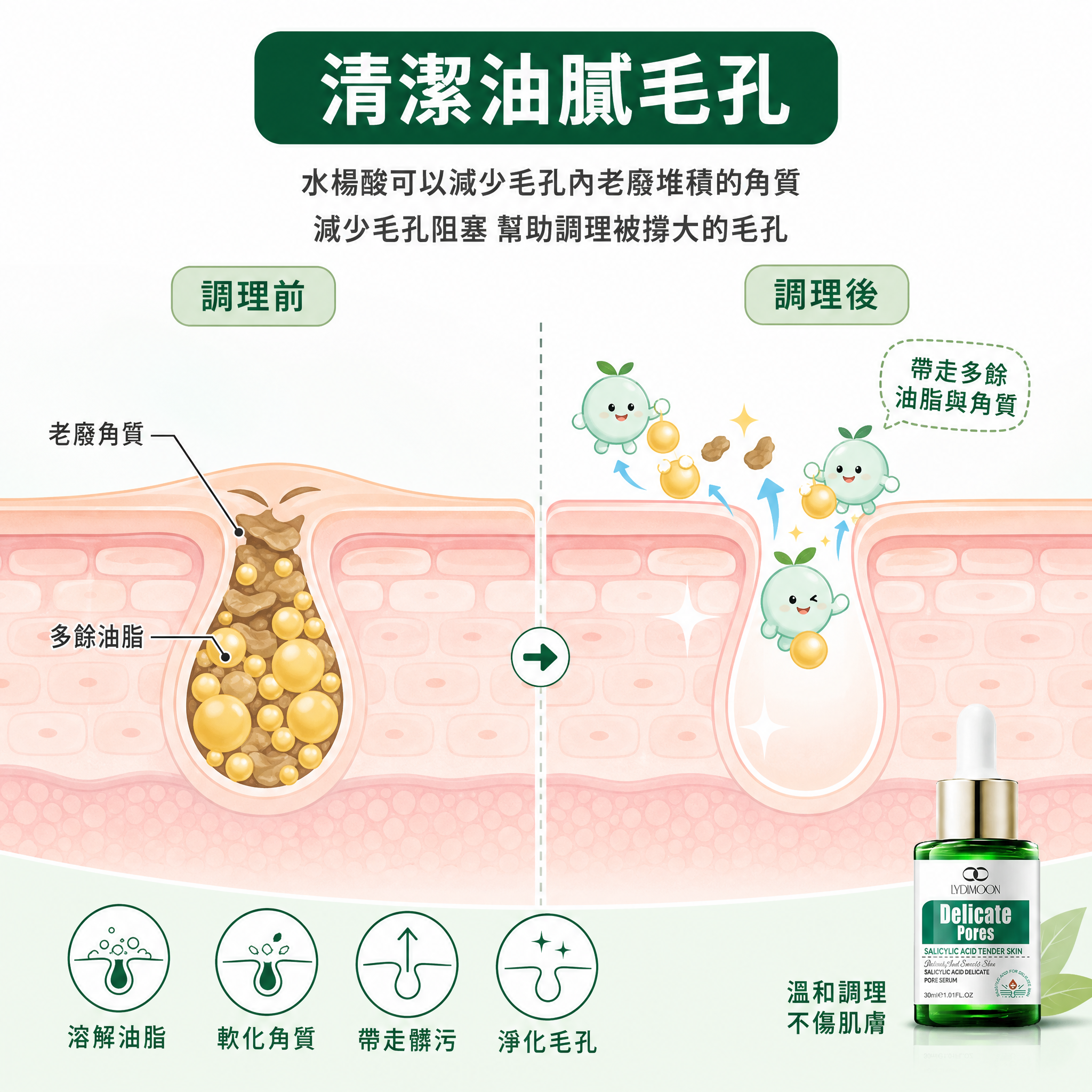 [主圖-4] 作用原理示意圖 清潔毛孔機制插畫。 [氛圍風格]… - 图片创意预览