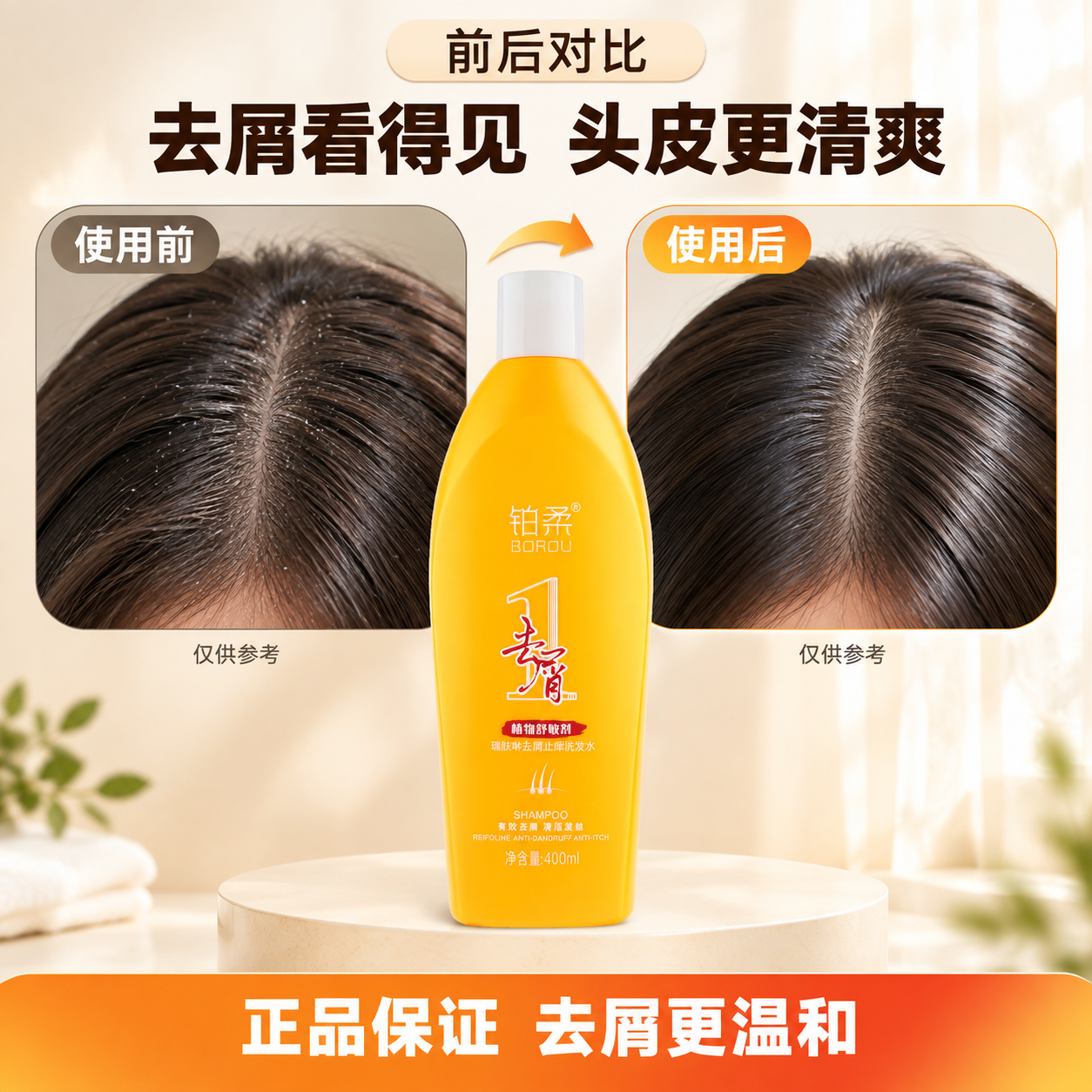 [主图-4] 痛点对比/前后对比图：使用前后对比展示去屑止痒改… - 图片创意预览