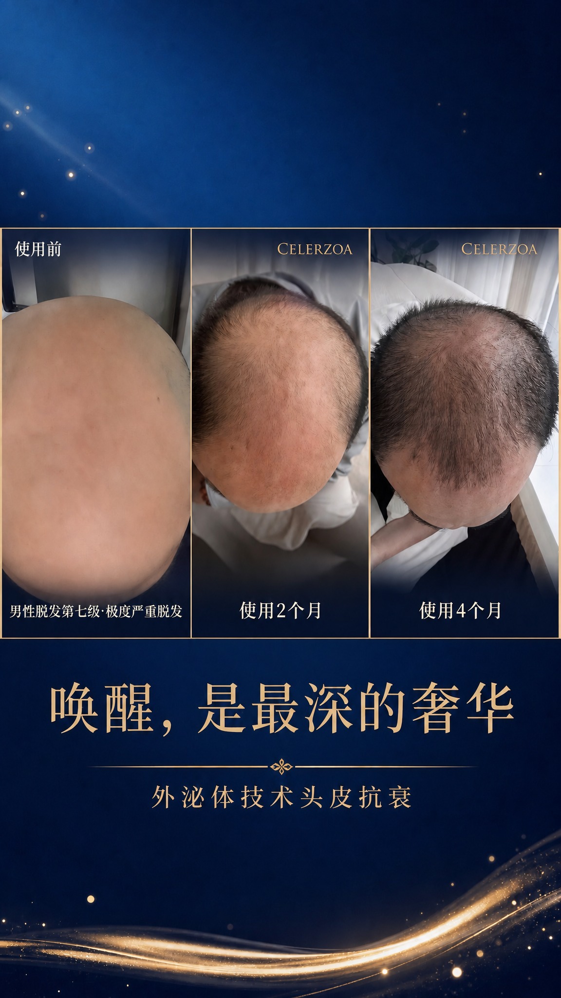 将这张海报的背景底图改为深蓝色渐变背景（深邃藏蓝色到宝蓝色渐变… - 图片创意预览