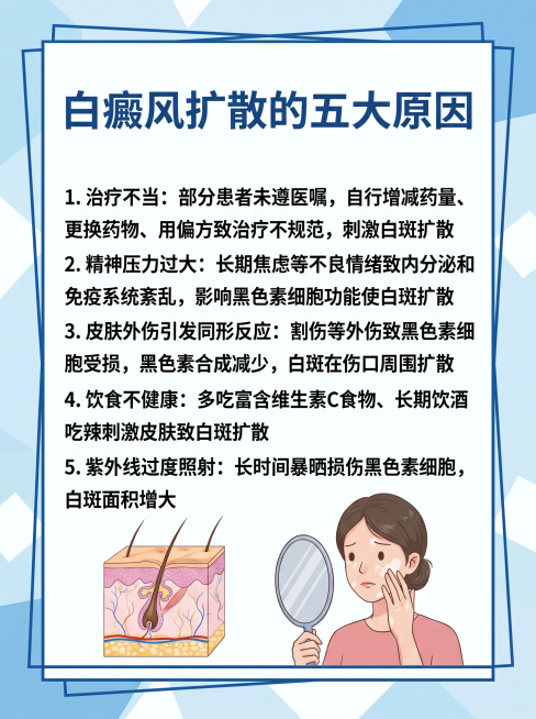 科普插画，主题为"白癜风扩散的五大原因"，内容包括：1.治疗不当：部分患者未遵医嘱，自行增减药量、更换药物、用偏方致治疗不规范，刺激白斑扩散；2.精神压力过大：长期焦虑等不良情绪致内分泌和免疫系统紊乱预览效果
