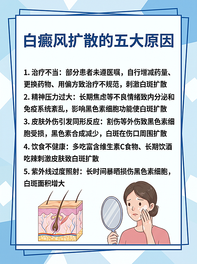 科普插画，主题为"白癜风扩散的五大原因"，内容包括：1.治疗不当：部分患者未遵医嘱，自行增减药量、更换药物、用偏方致治疗不规范，刺激白斑扩散；2.精神压力过大：长期焦虑等不良情绪致内分泌和免疫系统紊乱，影响黑色素细胞功能使白斑扩散；3.皮肤外伤引发同形反应：割伤等外伤致黑色素细胞受损，黑色素合成减少，白斑在伤口周围扩散；4.饮食不健康：多吃富含维生素C食物、长期饮酒吃辣刺激皮肤致白斑扩散；5.紫外线过度照射：长时间暴晒损伤黑色素细胞，白斑面积增大。更换简约风格的边框模板，保持画面清晰、风格简约，图片尺寸比例保持3:4不变，保留皮肤病理示意图和女性照镜子检查白斑的插画元素，排版清晰。