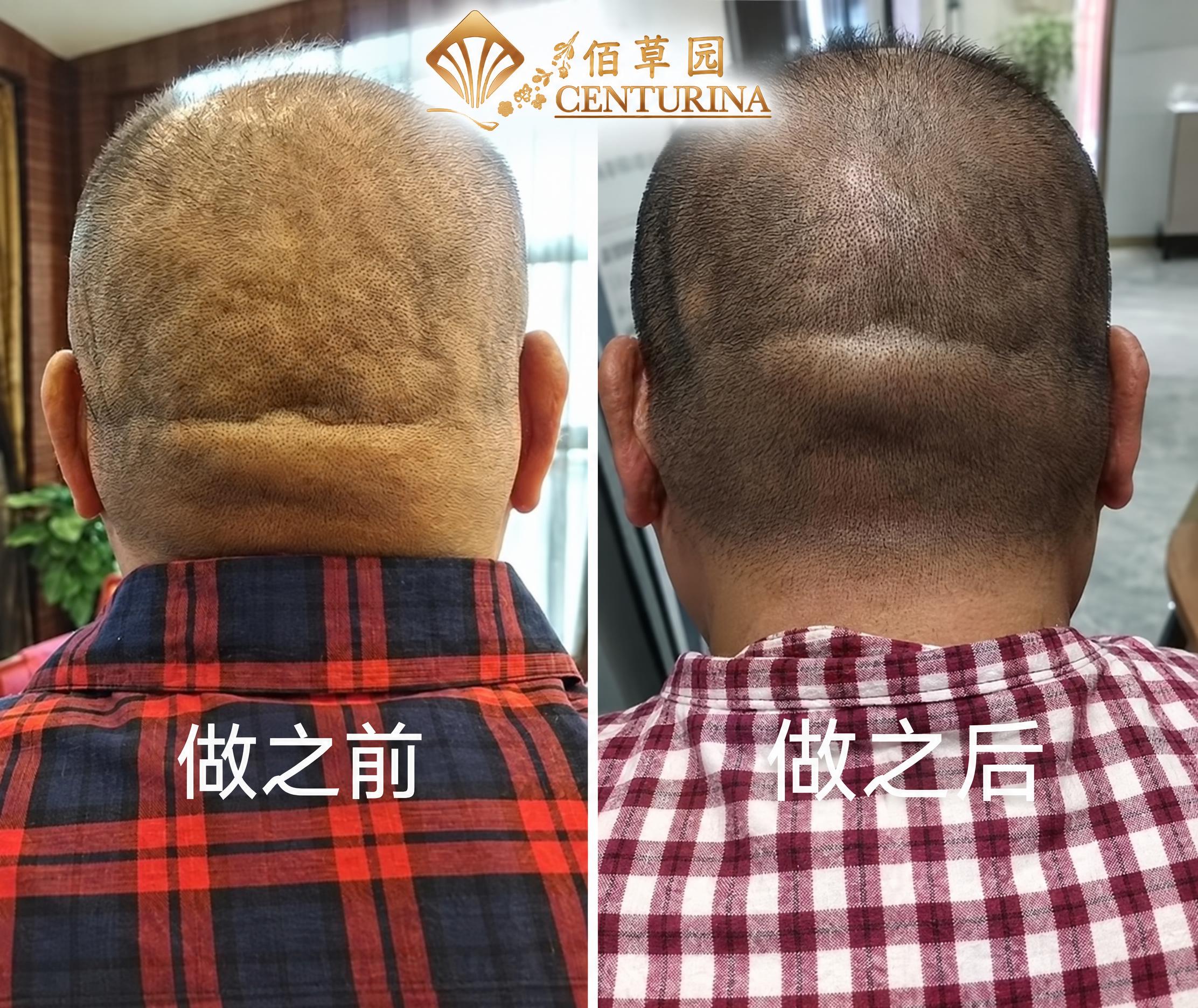 将图中的所有原有logo、品牌标识和无关文字标识全部移除，然后… - 图片创意预览