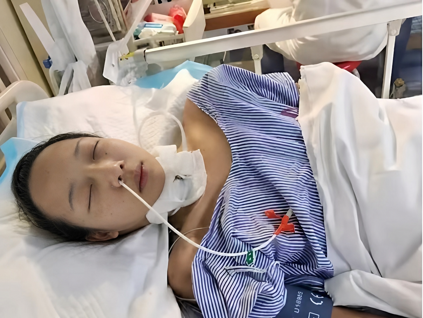 将图1中打马赛克的头部替换为图2的脸部，保持图2脸部所有细节完… - 图片创意预览