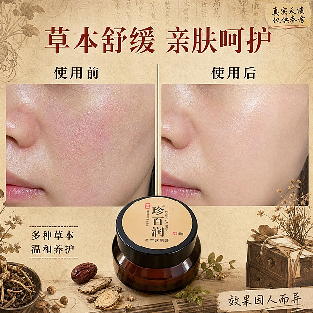 [主图-3] 珍百润草本熬制膏使用前后反馈效果图，小红书风格真实反馈感，中药风格背景。
[统一基调] 中药国风视觉，背景主色为深棕+米黄宣纸质感，点缀草本植物线描与古药方纹理，标题字色为赭石红，辅助字色为深褐，强调色为鎏金，字体选用雅致宋体，整体温润古朴有小红书原生氛围感。
[画面] 画面采用左右分栏对比布局，左侧为「使用前」局部皮肤状态特写（表现皮肤干燥泛红不适状态，真实自然不夸张），右侧为「使用后」同部位皮肤状态特写（表现皮肤舒缓润泽状态），中间用竖线分隔，上方标注「使用前」「使用后」字样。画面底部中央放置珍百润草本熬制膏小瓷罐产品图，占画面约25%。背景为米黄色宣纸质感，四角点缀干草本植物与古朴药柜纹理。右上角有小红书风格手写体小标签「真实反馈 仅供参考」。
[光影质感] 自然光效，皮肤特写真实自然，有细腻皮肤纹理，产品瓷罐有温润质感，整体真实摄影风格带轻微小红书滤镜氛围感。
[配色] 米黄宣纸底+深褐文字+赭石红标题+自然肤色，整体暖调中药风。
[文字版式] 主标题「草本舒缓 亲肤呵护」用大号宋体赭石红色，位于画面顶部居中；「使用前」「使用后」用深褐色中号字分别标注在左右图上方；底部产品旁有小字「多种草本 温和养护」；右下角有手写体小字「效果因人而异」；所有文字清晰不遮挡关键画面。
[输出要求] 1:1正方形比例，2K高清，产品清晰不变形，文字清晰无错字，画面干净有质感，无水印无平台Logo，禁止夸张对比、禁止医疗功效宣称、禁止出现化学成分和生产厂家信息、禁止极限词。