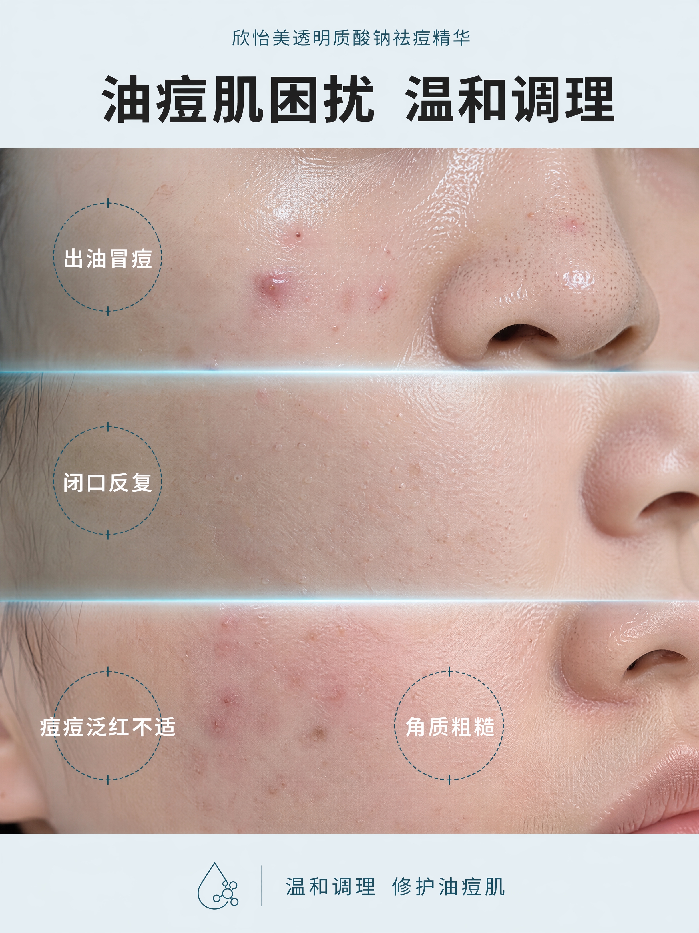 参考图1的版式结构（顶部大标题+下方三段横向分割的肌肤问题特写… - 图片创意预览