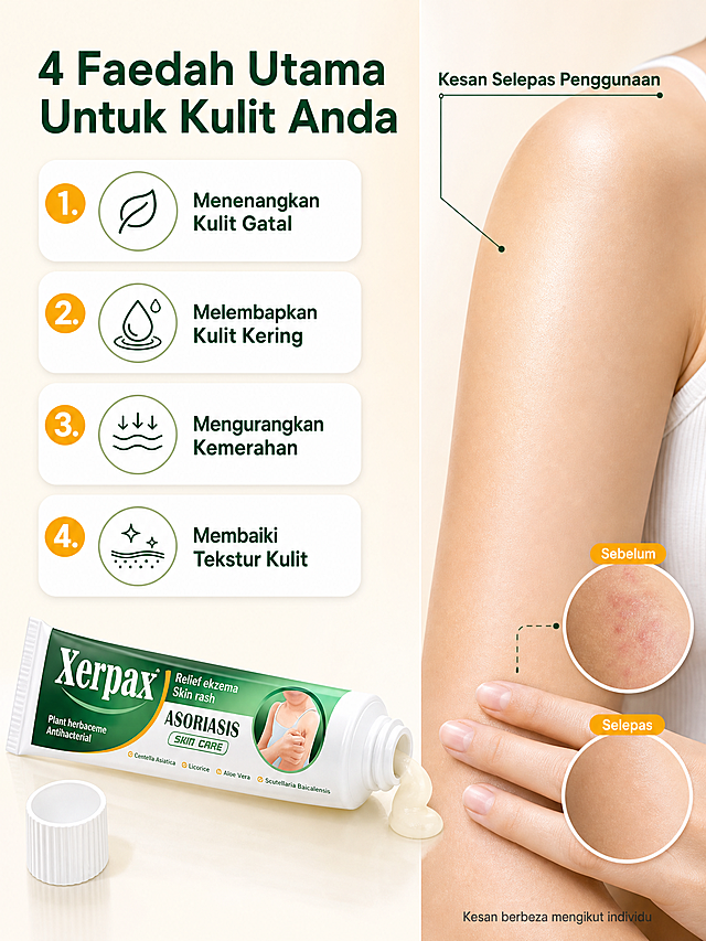 [商品] 使用【图1】Xerpax Asoriasis Krim Kulit 20g皮肤软膏软管；保留深绿色+白色+橙黄色包装、Xerpax品牌Logo、软管外观、颜色、材质和比例。
[画面] 页面目标：四大核心功效+真人局部效果实证。左右分栏构图，左侧为产品+功效说明，右侧为真人皮肤局部效果展示。左侧：打开盖子的软膏软管放置在左下方，管口挤出少量乳白色膏体；上方有4个编号功效卡片，竖排排列。右侧：东南亚女性手臂/肩部皮肤局部特写（不露出面部），展示使用后的健康光滑皮肤状态，肤色均匀有光泽；旁边有before/after的小圆形对比图，温和展示改善效果，不夸大。背景是浅米色到白色的柔和渐变。
[视觉] 套系策略：风格=东南亚清新明亮商业摄影风；标题字=现代无衬线粗体（马来语）；正文字=简洁无衬线体；主色=深森林绿；背景延展=浅米-白色渐变，干净柔和；强调色=暖橙黄色，仅用于功效编号和before/after标签；标题色=深森林绿；正文色=深炭灰；组件=圆角白色功效卡、细线引线、圆形对比图；光影=左前侧暖柔光，皮肤质感真实自然。
[文字] 顶部大标题："4 Faedah Utama Untuk Kulit Anda"；左侧4个功效卡片："1. Menenangkan Kulit Gatal"、"2. Melembapkan Kulit Kering"、"3. Mengurangkan Kemerahan"、"4. Membaiki Tekstur Kulit"；右侧效果区上方标注："Kesan Selepas Penggunaan"；before/after图分别标注"Sebelum"和"Selepas"；底部小字："Kesan berbeza mengikut individu"；所有文字为马来语，横排。
[规格] 图片比例3:4竖版，4K分辨率，避免变形、错字、面部出现、手部畸形、医疗夸大对比、中文出现、产品颜色改变。