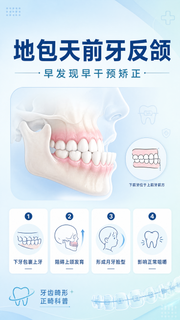 专业医疗科普风格口腔正畸海报，写文案 "地包天前牙反颌" 大字主标题，副标题 "早发现早干预矫正"，左下角标注装饰文案 "牙齿畸形 正畸科普"，四个卖点分别标注：1.下牙包裹上牙 2.阻碍上颌发育 3预览效果