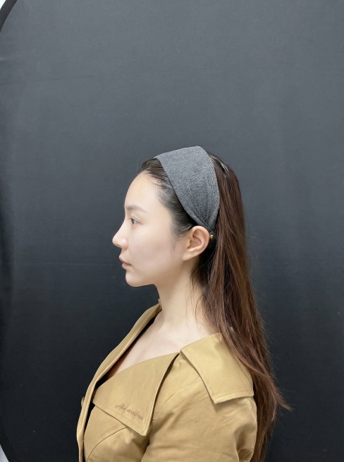 把图片中人物嫩肤美白，下颌线调整清晰，画面比例不变，背景色调也不要动。预览效果