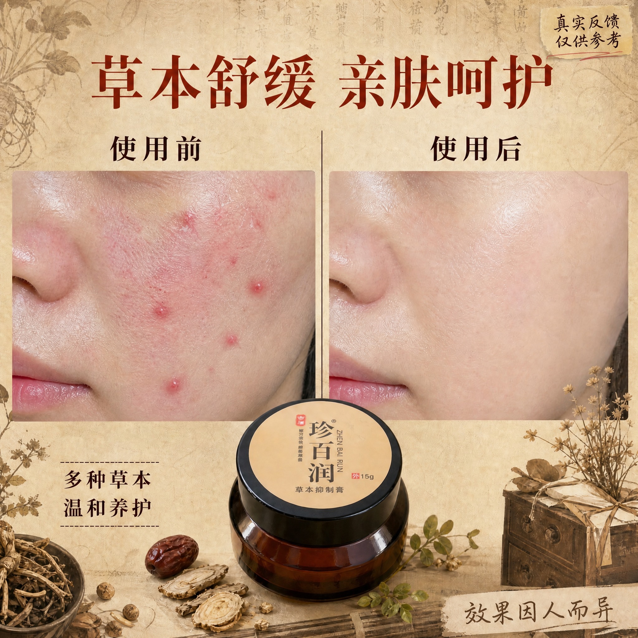在原图基础上修改，左侧"使用前"的脸部特写中，让脸颊上的痘痘更… - 图片创意预览