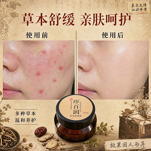 在原图基础上修改，左侧"使用前"的脸部特写中，让脸颊上的痘痘更加明显突出，增加几颗清晰可见的红色痘痘和粉刺，泛红区域更明显，肌肤问题更突出，形成更强烈的使用前后对比效果。右侧"使用后"保持肌肤光滑细腻不变。产品罐子、文字排版、背景风格、草本装饰元素全部保持原样不变。产品100%还原上传商品图的外形、包装、LOGO、印刷文字、净含量。
