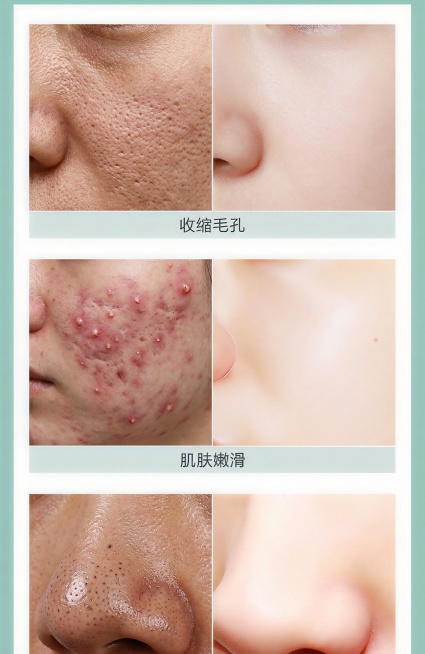 左边根据皮肤情况弄严重点预览效果