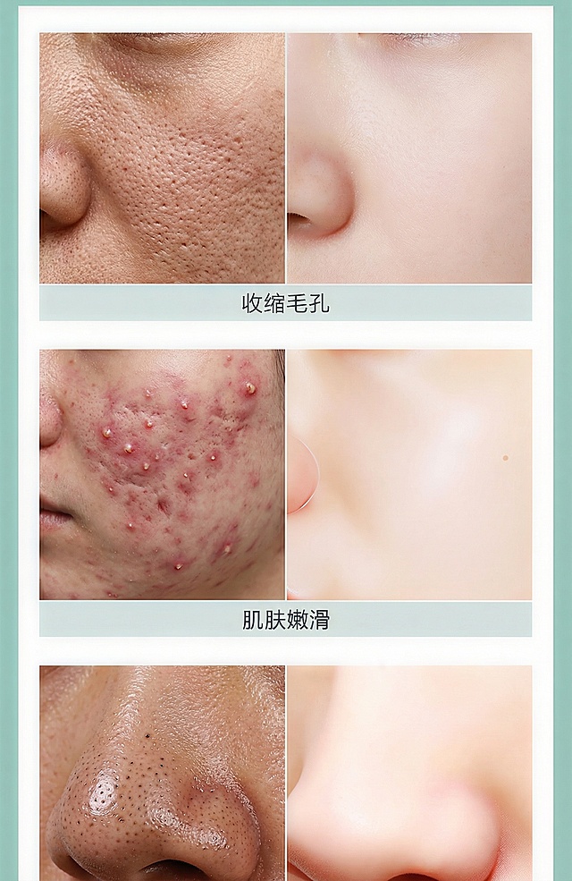 左边根据皮肤情况弄严重点