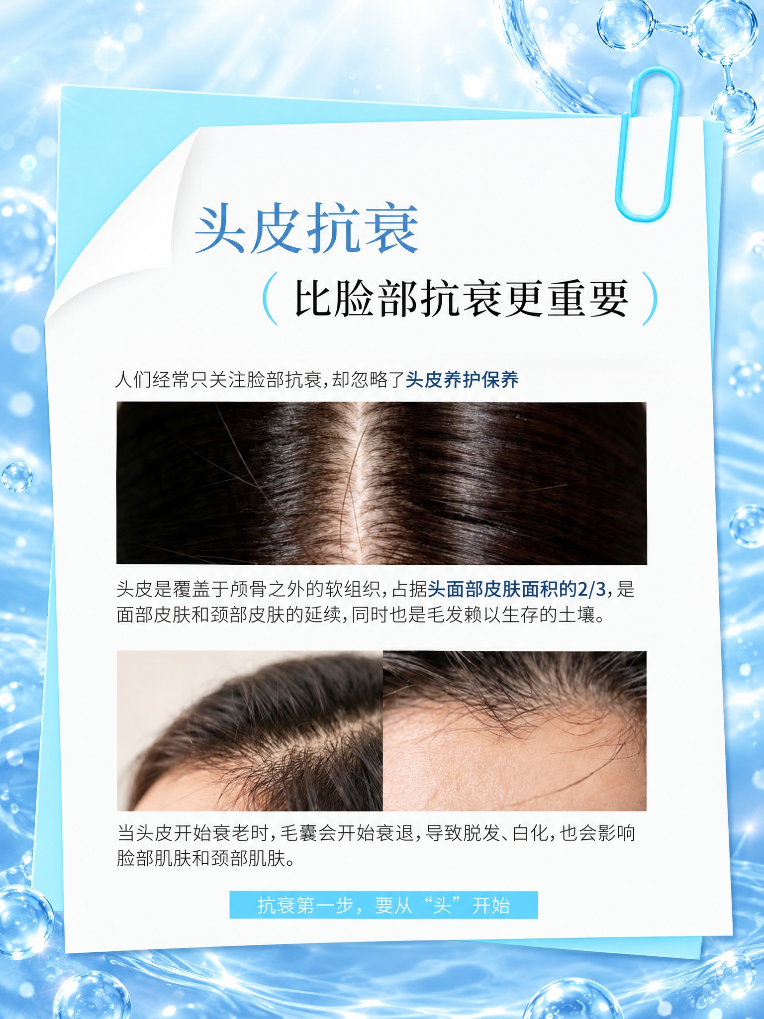 将图片背景替换为第三张参考图的蓝色水光分子背景风格：淡蓝色流动… - 图片创意预览