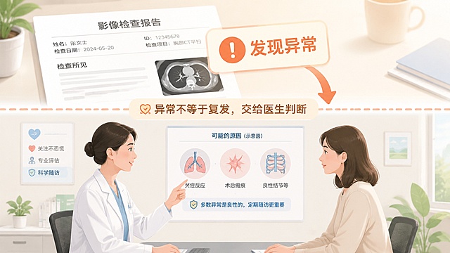 画面分为上下两部分，上方一份报告上有柔和的橙色感叹号标注“发现异常”，旁边箭头指向下方，下方一位医生正指着墙上示意图向患者讲解，患者神情专注而平静，上下由柔和虚线隔开，虚线旁标注“异常不等于复发，交给医生判断”，传递理念：异常需要关注但不必恐慌，整体氛围温暖理性安心，干净简约的医疗插画风格，横版构图，16:9比例