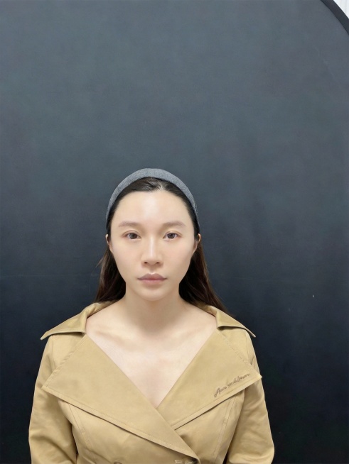 两边颧骨太阳穴不对称，帮我在修整一下。预览效果