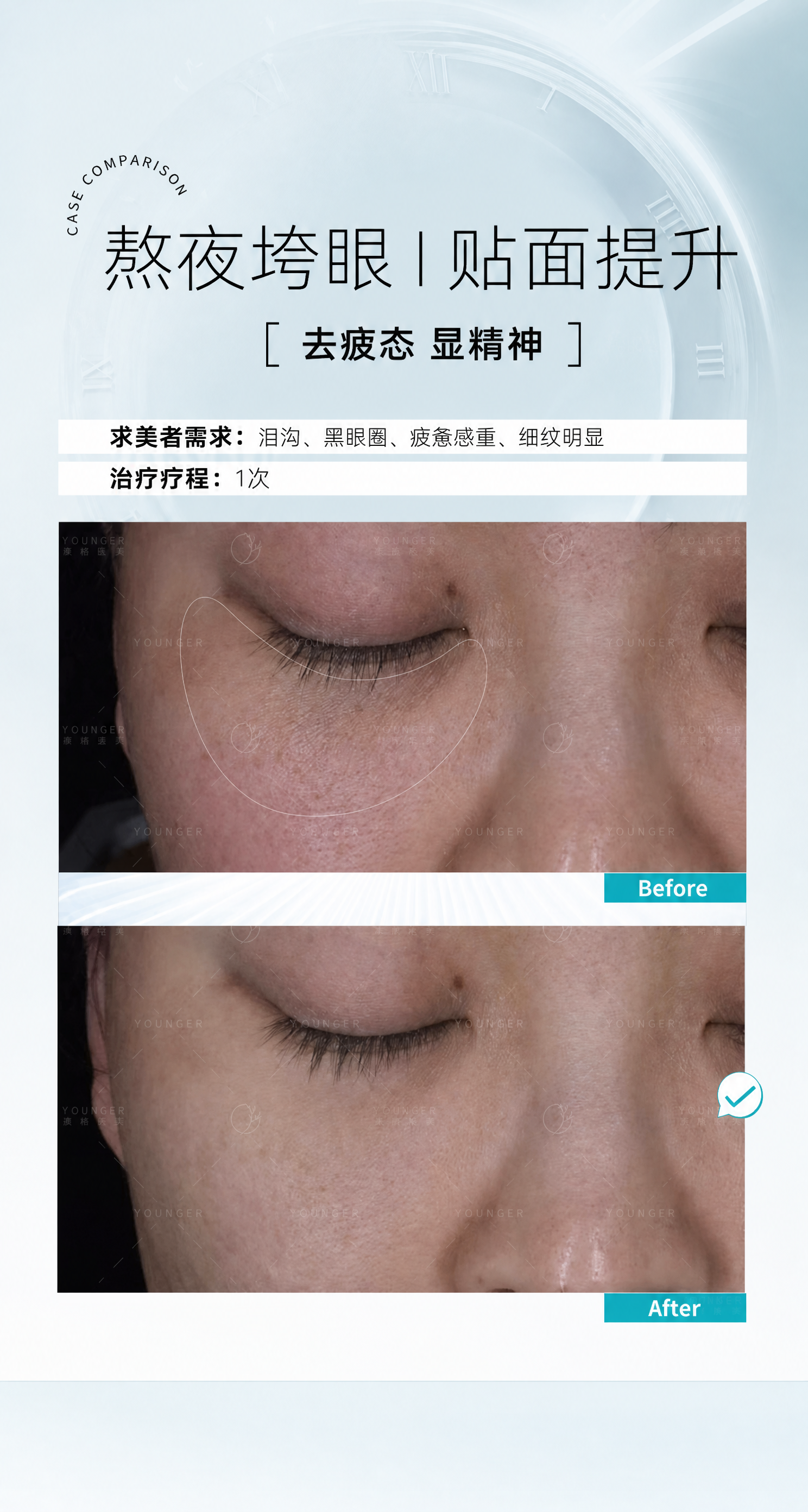 基于参考图进行精确复刻修改，保留原图的版式骨架、上下对比图结构… - 图片创意预览