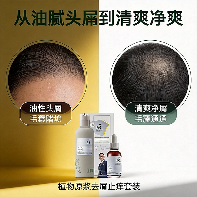 [主图 4] 头皮清洁护理痛点改善对比主图
[氛围风格] 清晰对比，直观有说服力，干净简约风格
[画质] 高清对比摄影，明暗清晰，产品真实质感
[元素] 左右分栏对比排版，左侧圆形圆角框展示油性头屑问题头皮，标注标签「油腻头屑 毛囊堵塞」，右侧圆形圆角框展示使用后清爽干净头皮，标注标签「清爽净屑 毛囊通畅」，去屑款套装产品放在两个对比框下方居中位置。保持产品外观与输入产品图绝对一致，杜绝变形色差，精细化处理。整体布局不拥挤，主体突出
[光影] 均匀柔和光影，对比框明暗对比适中，产品清晰不暗沉
[配色] 左侧偏暗偏黄调突出问题，右侧干净亮调突出改善，产品保持原有配色，整体简约干净
[文字版式] 顶部放置主标题「从油腻头屑到清爽净爽」深绿色粗体，对比框内标签用白色字配半透明深色底保证可读性，产品下方标注产品名「植物原浆去屑止痒套装」字号适中
[比例分辨率] 1:1 比例，2k 分辨率，文字清晰可辨，超高清
[负向提示词] 变形，水印，文字错乱，产品图模糊，背景杂乱，夸张过度，虚假对比