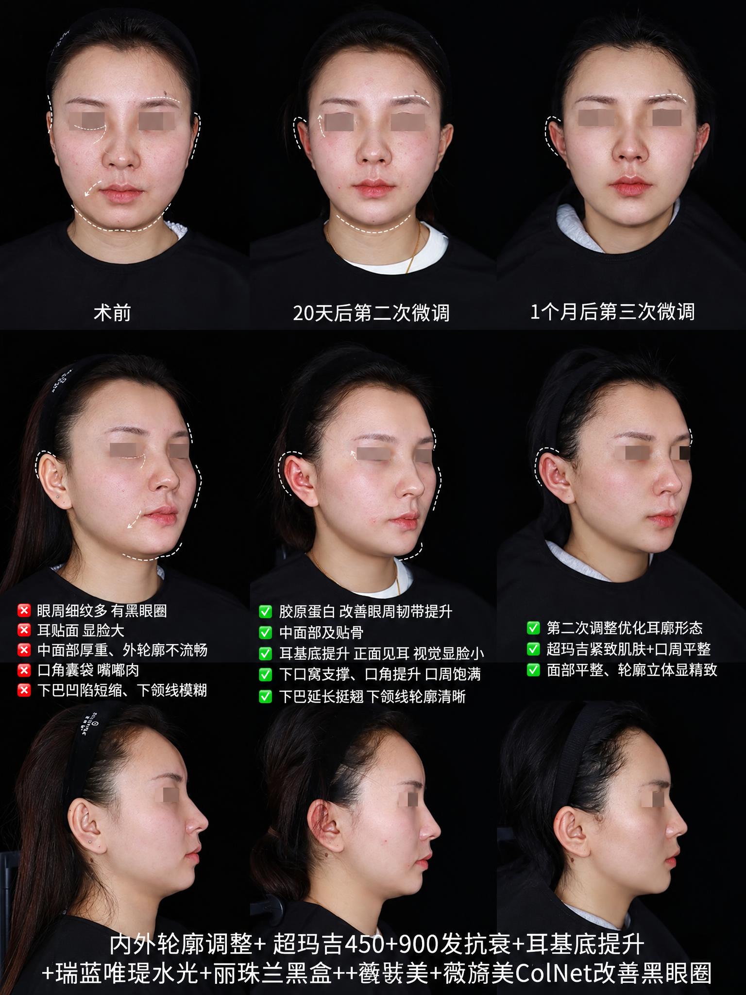 去除图片中所有的“皙疗 X CLINIC”水印文字，保持原图的… - 图片创意预览