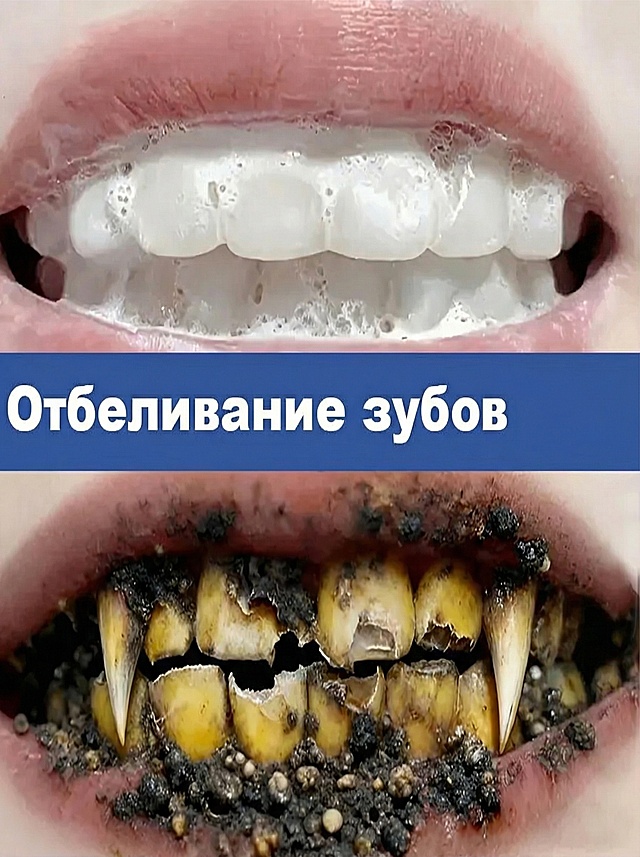 去掉图片右侧的牙膏管