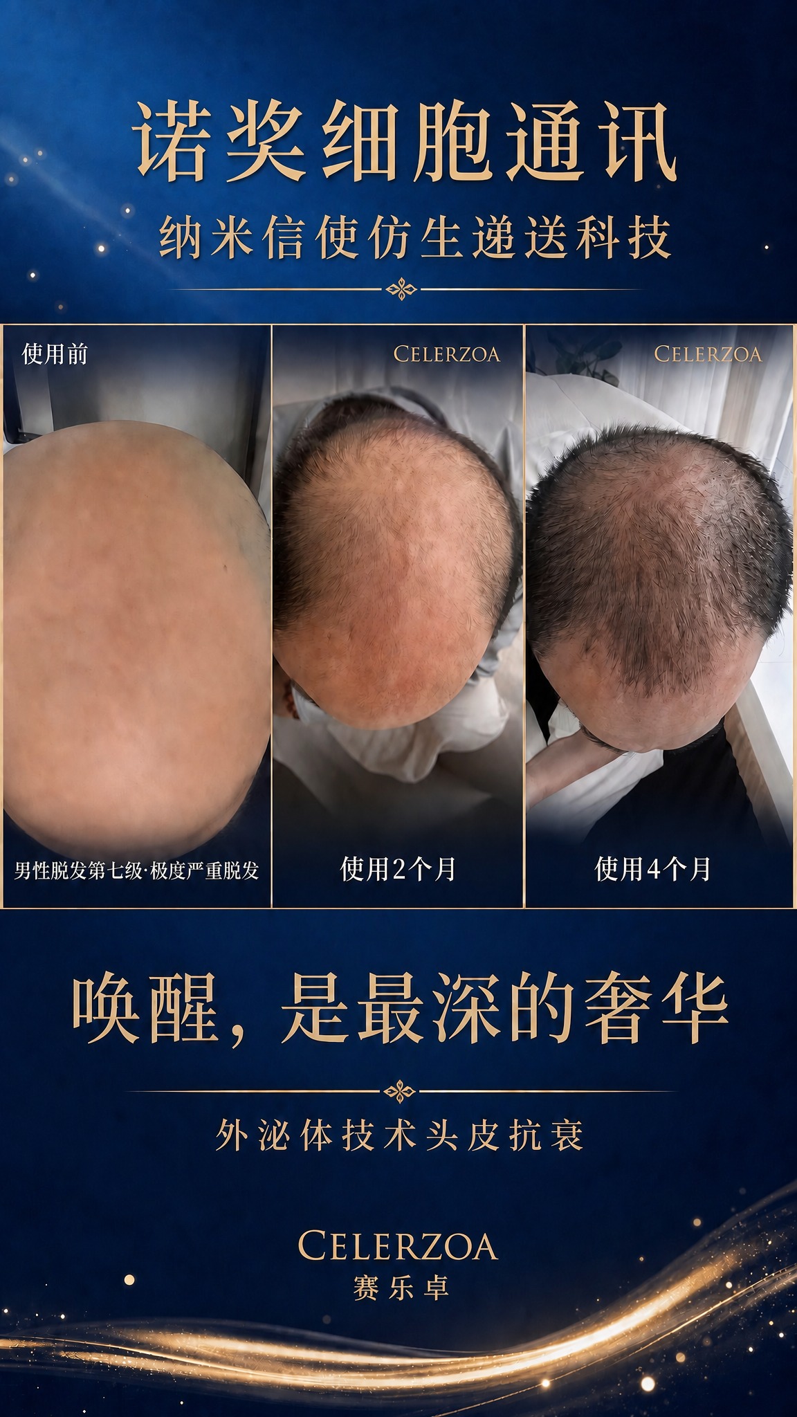 在这张深蓝色背景海报的图片上半部分（三栏对比照片的上方区域），… - 图片创意预览