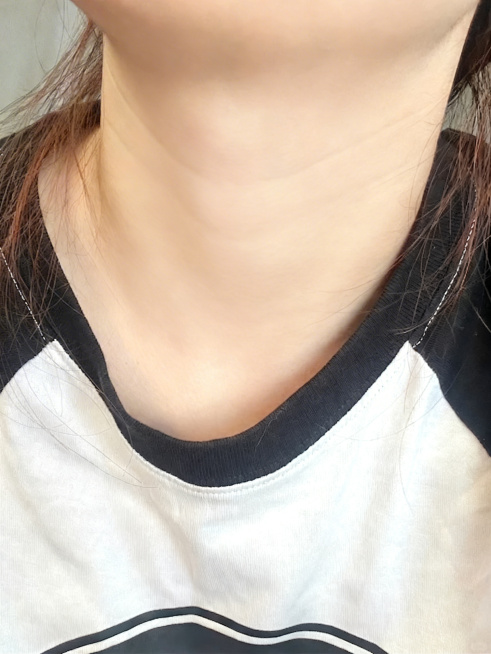 减少脖子部位的鸡皮，让皮肤更加平滑细腻，保持整体自然真实，不改变图片其他内容预览效果
