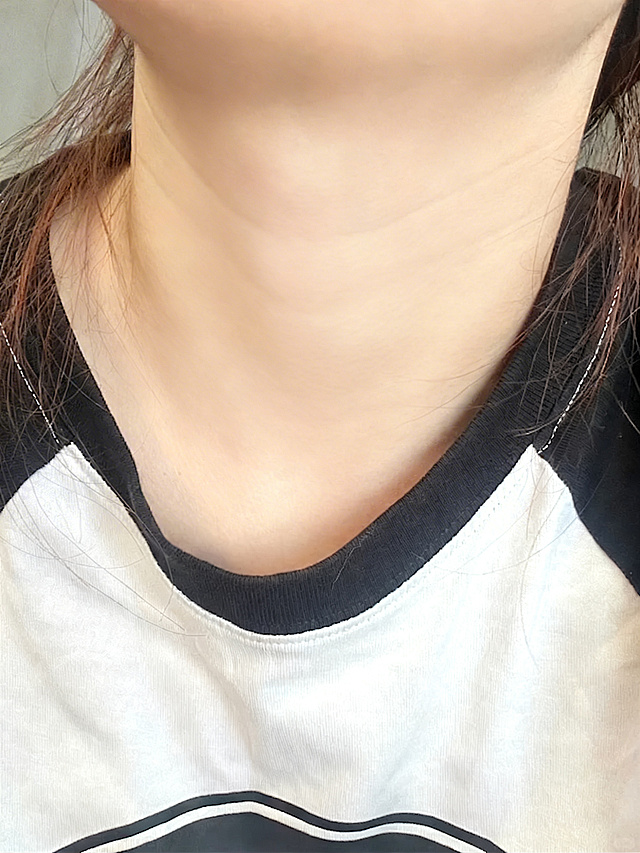 减少脖子部位的鸡皮，让皮肤更加平滑细腻，保持整体自然真实，不改变图片其他内容