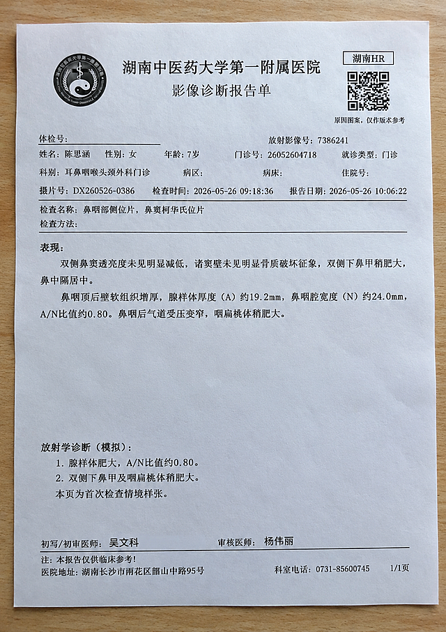 将这张医院影像诊断报告单模拟成打印出来后用手机拍摄的效果，纸张平放在桌面上，能清晰看到纸张的四个边角，有轻微的自然透视角度，真实的纸质纹理，柔和的室内自然光，边缘有自然阴影，画面真实自然，保持报告单上所有文字和图案清晰可辨