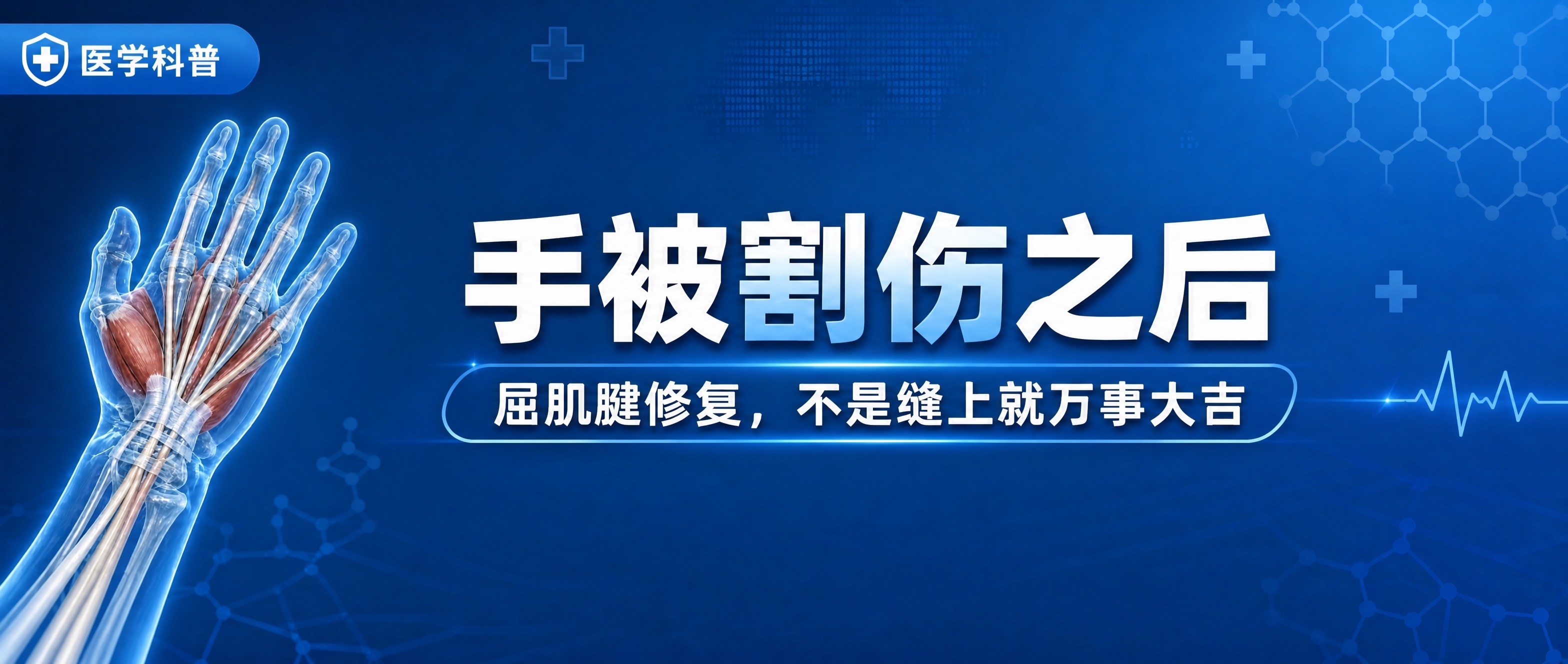 将主标题"手被割伤之后"和副标题"屈肌腱修复，不是缝上就万事大… - 图片创意预览