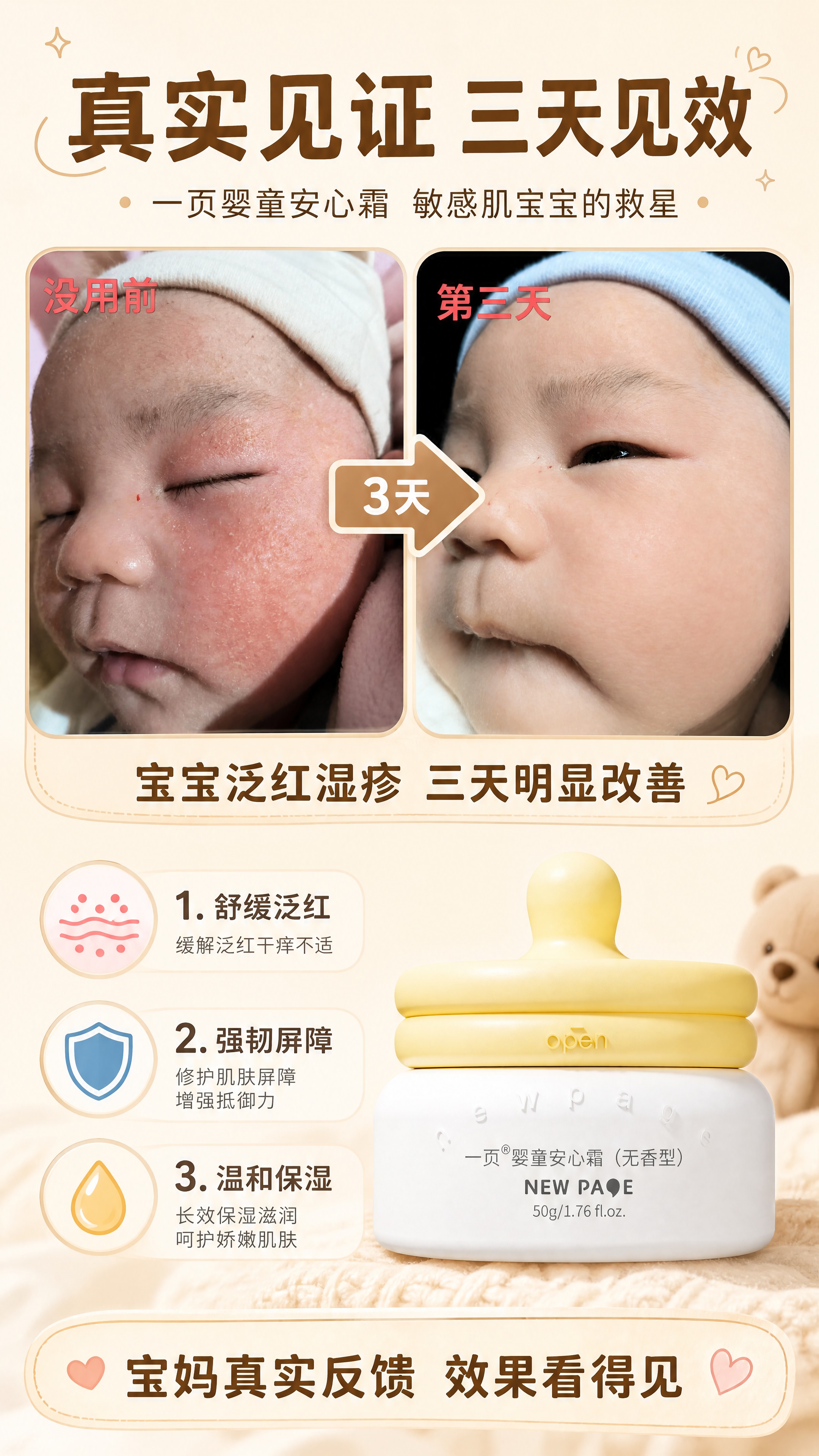 一页婴童安心霜真实对比功效海报，竖版，暖米色母婴温馨风格。顶部… - 图片创意预览