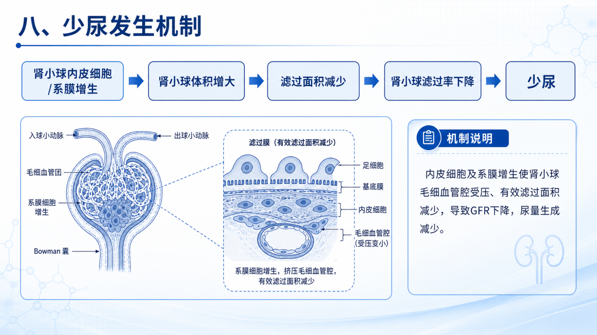 医学PPT页面，标题是"八、少尿发生机制"，内容：肾小球内皮细胞系膜增生→肾小球体积增大→滤过面积减少→肾小球滤过率下降→少尿，机制示意图配文字说明，蓝白配色预览效果