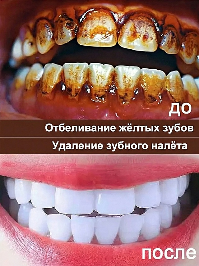 去掉图片左边的牙膏管