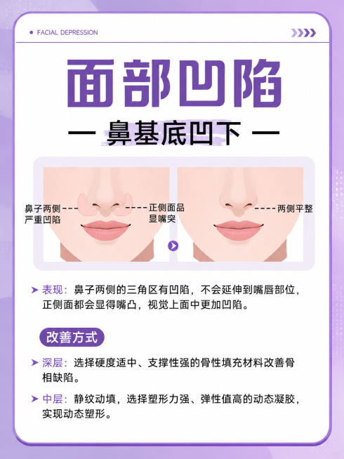 参考原图风格，重新生成面部凹陷科普海报，调整排版和背景，将主色调改为紫色，保留原图所有文字内容和对比图示结构预览效果