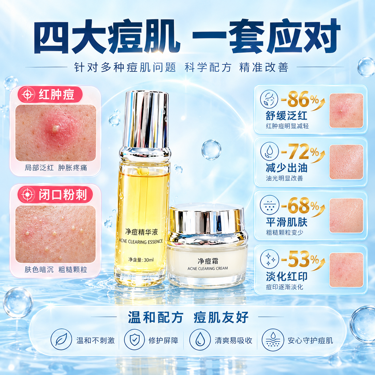 [主图-4] 痛点与使用场景实证，主题：针对四大痘肌问题 精准… - 图片创意预览