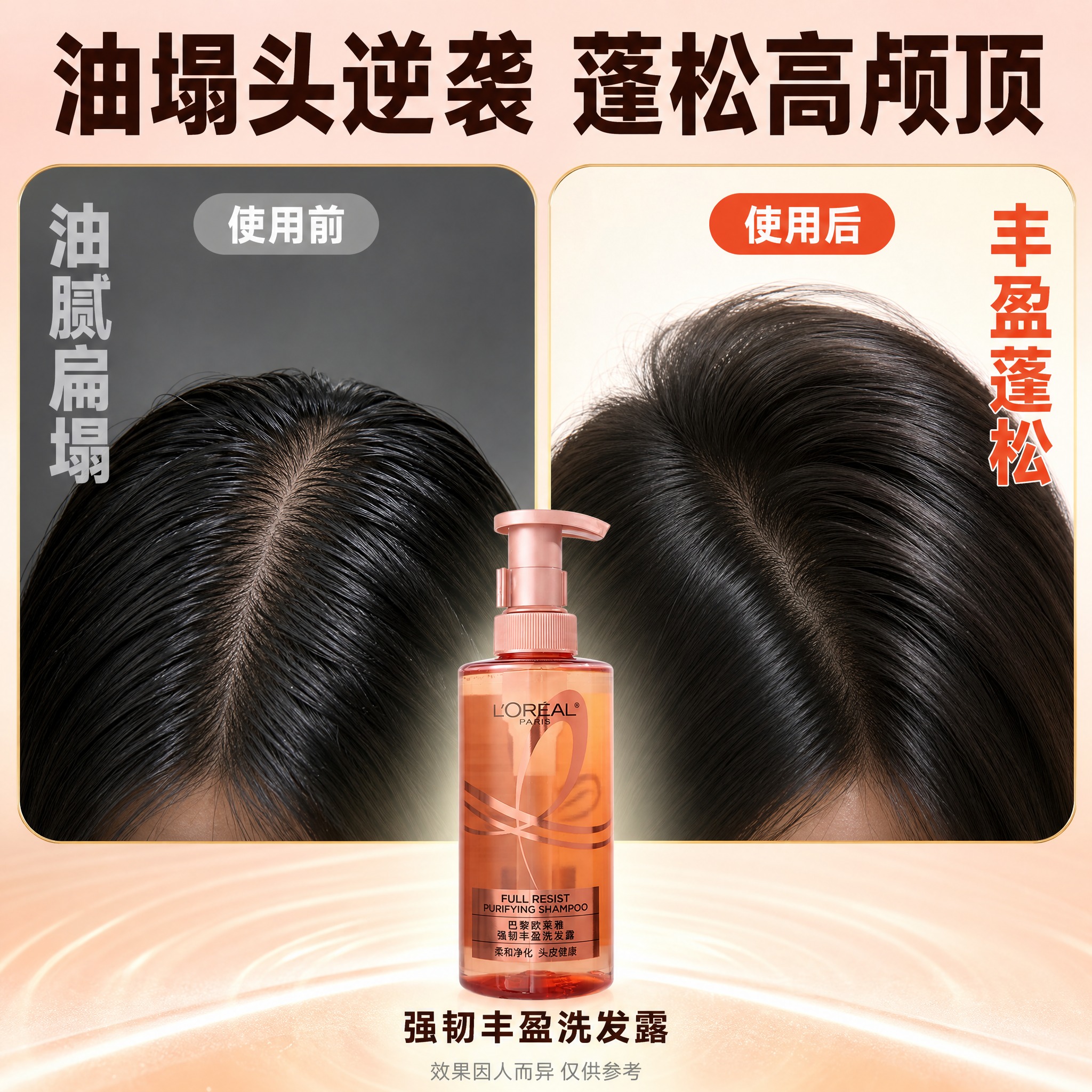 [主图-5] 痛点对比 油塌头vs蓬松发。 [统一基调] 拼多… - 图片创意预览