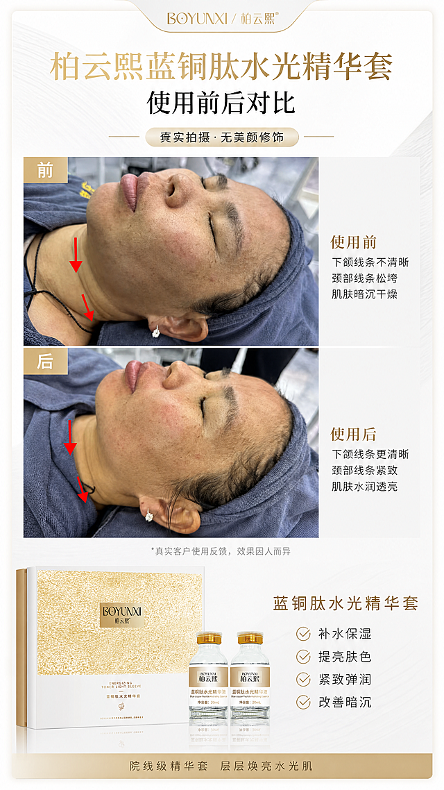 生成蓝铜肽水光精华套的使用前后对比图，保留原图内容，不要美颜美化皮肤，保持原图真实效果