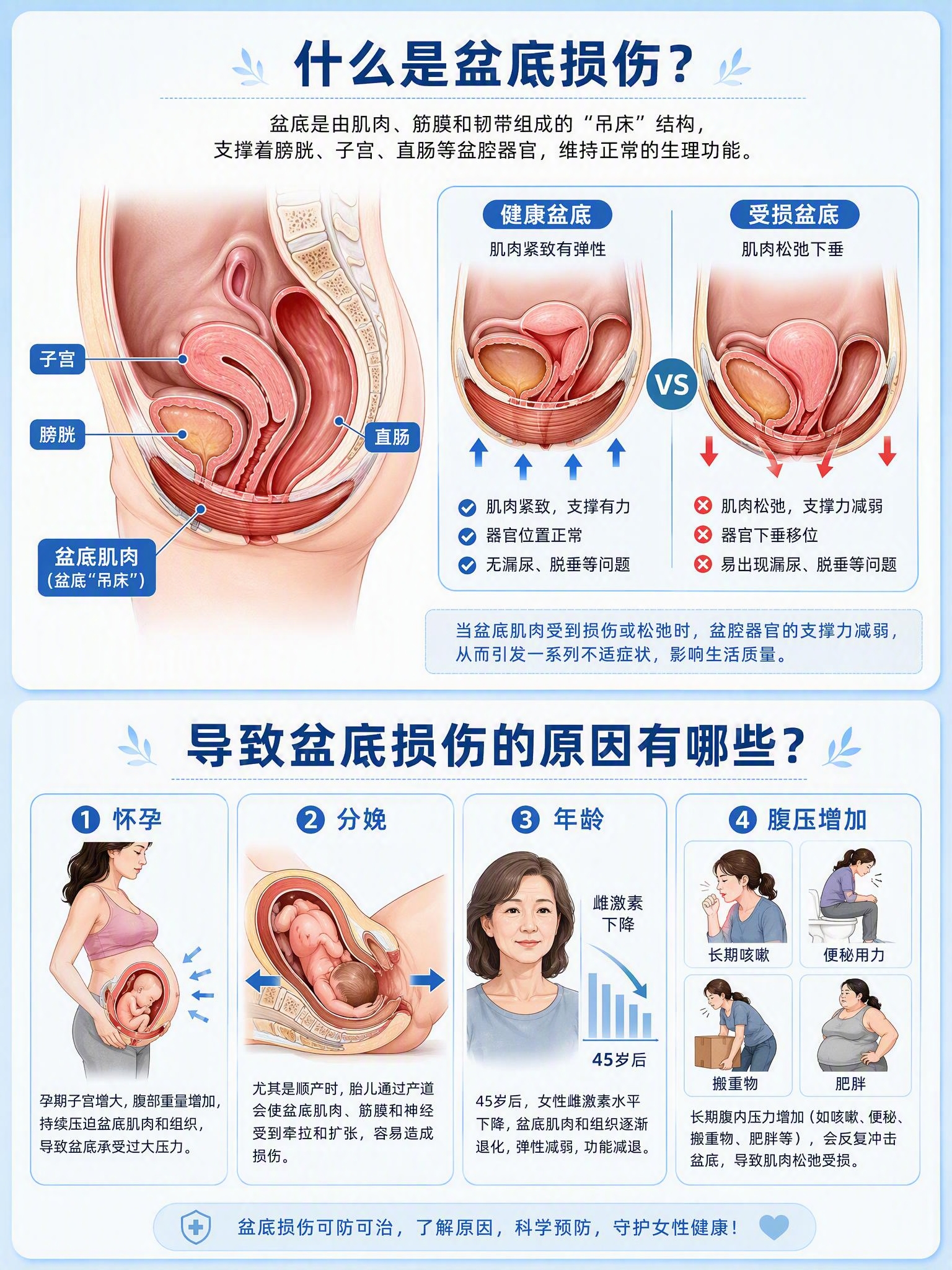 医疗科普插画，主题为盆底损伤科普，竖版3:4比例，2K分辨率，… - 图片创意预览