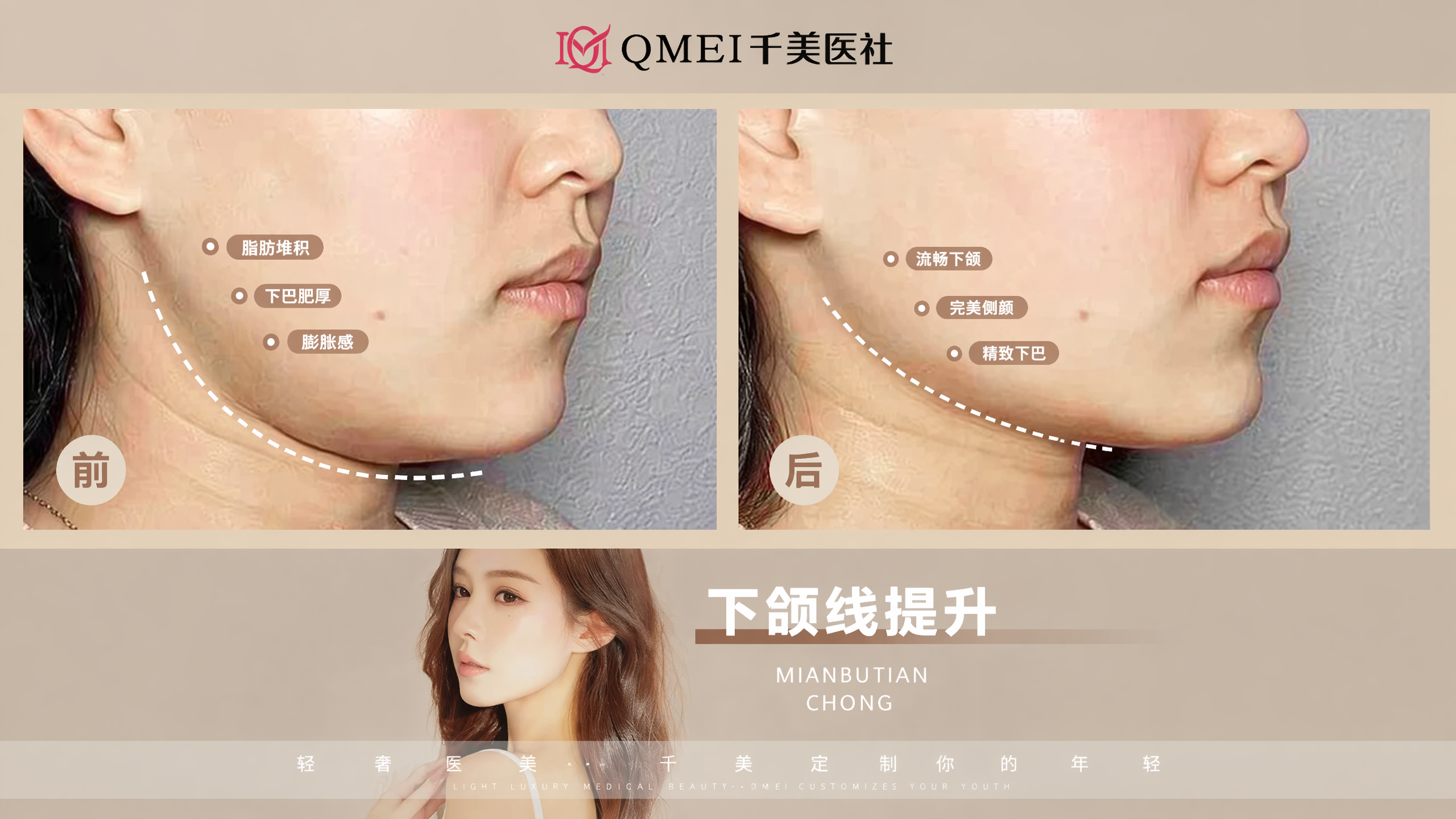 参考图片原有风格和内容，将图片整体变得更清晰，保留所有文字标注… - 图片创意预览