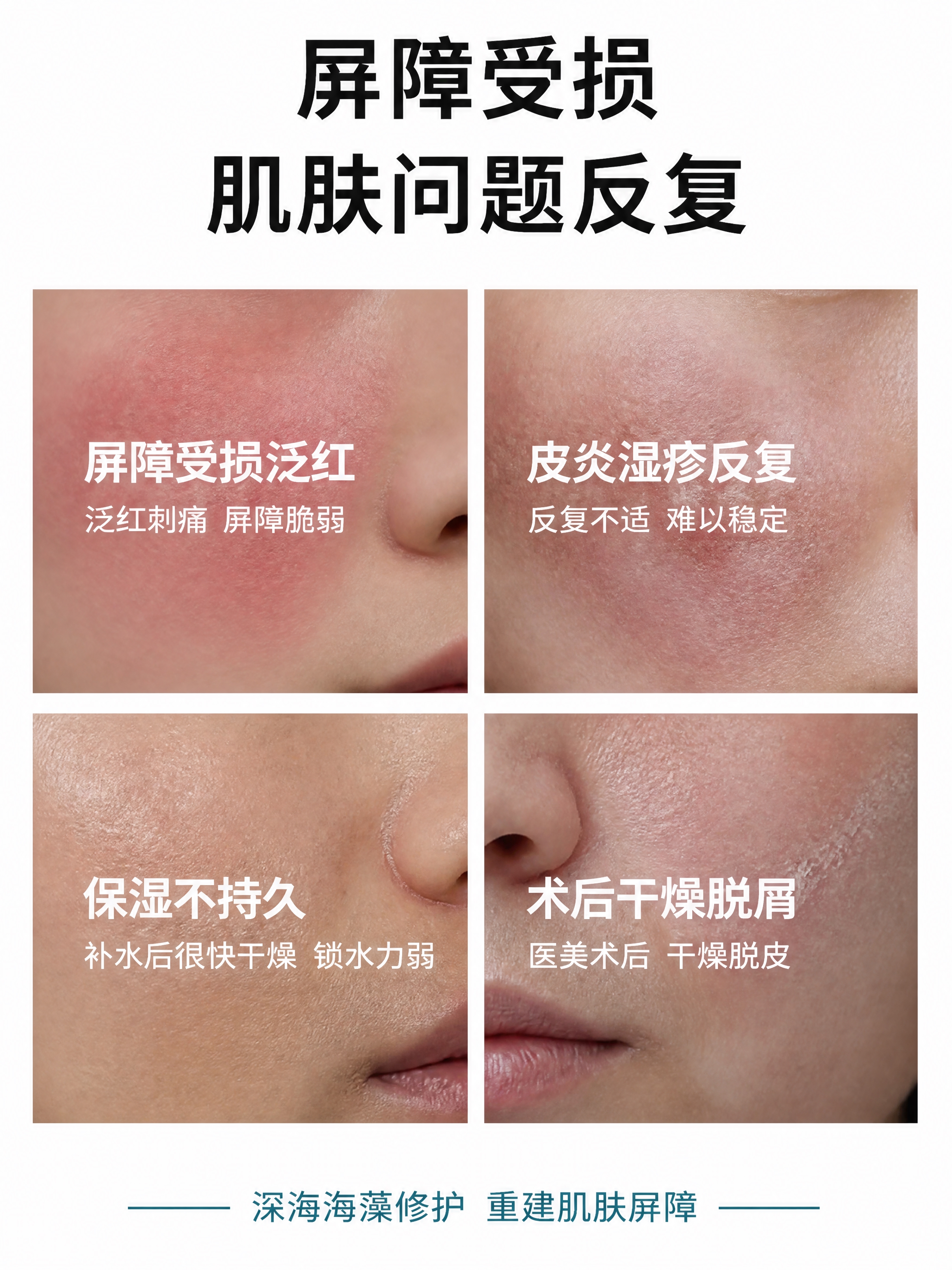 参考图1的版式结构（顶部大标题两行+下方2×2网格排列的四个肌… - 图片创意预览
